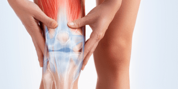 Understanding Osteoarthritis of the Knee: Symptoms, Imaging, and Chiropractic Treatment