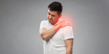 Thoracic Outlet Syndrome