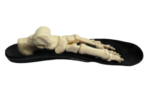 A skeleton foot on an orthotic