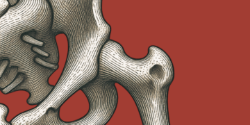 Hip Pain in Runners: What’s Going On and How to Get Back on Track