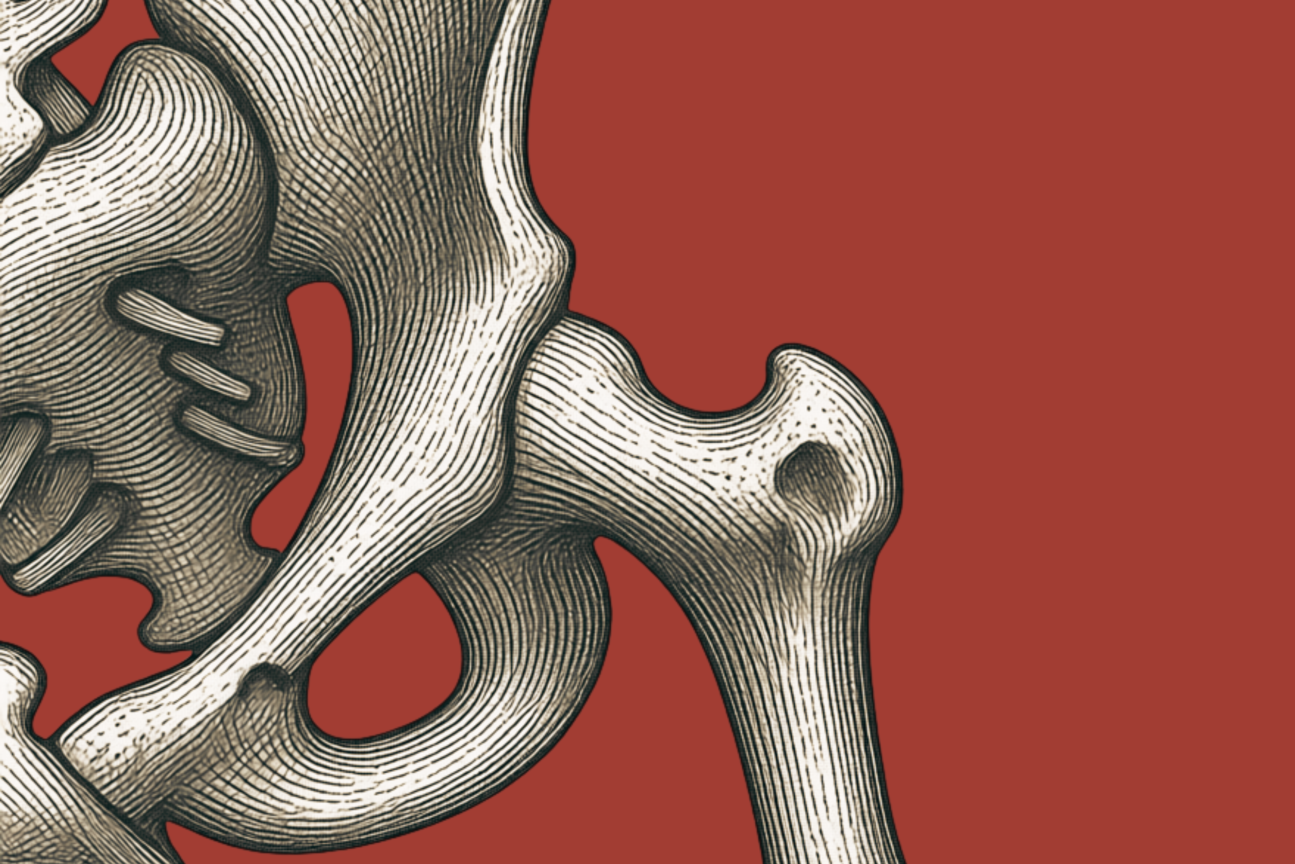Hip Pain
